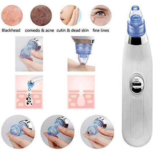 Derma Suction Facial SPA Blackhead Remover Machine 4 in 1 Black Head Remover Machine Acne Pore Cleaner Suction Tool Blackhead Removal Machine